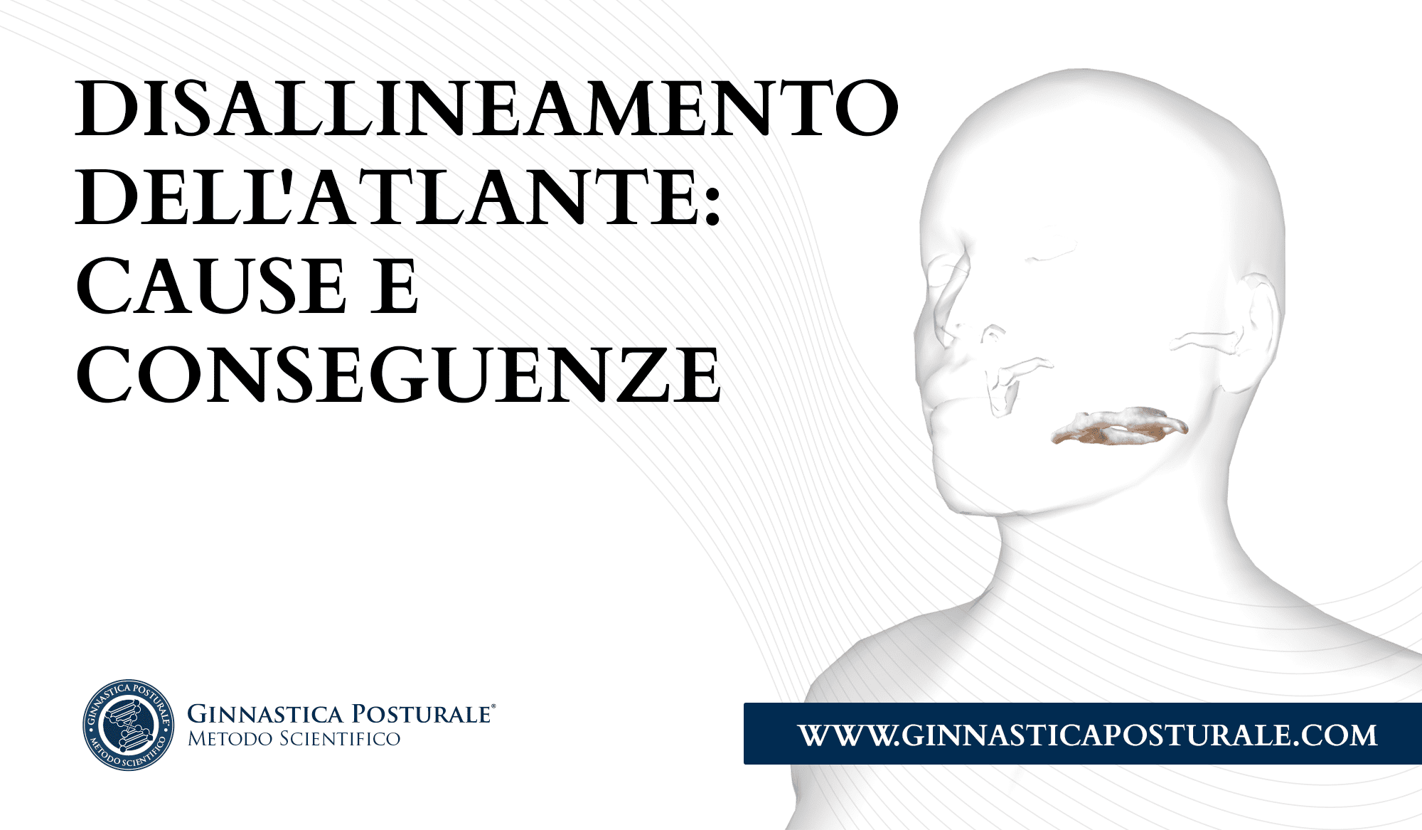 Disallineamento dell’Atlante: Cause, Conseguenze e Ginnastica Posturale