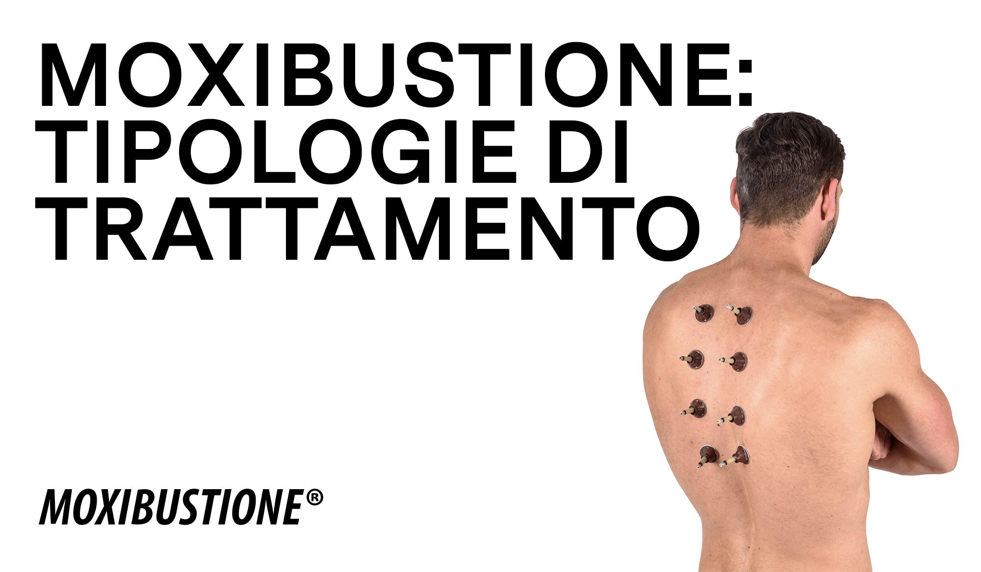 Tipologie di Moxibustione